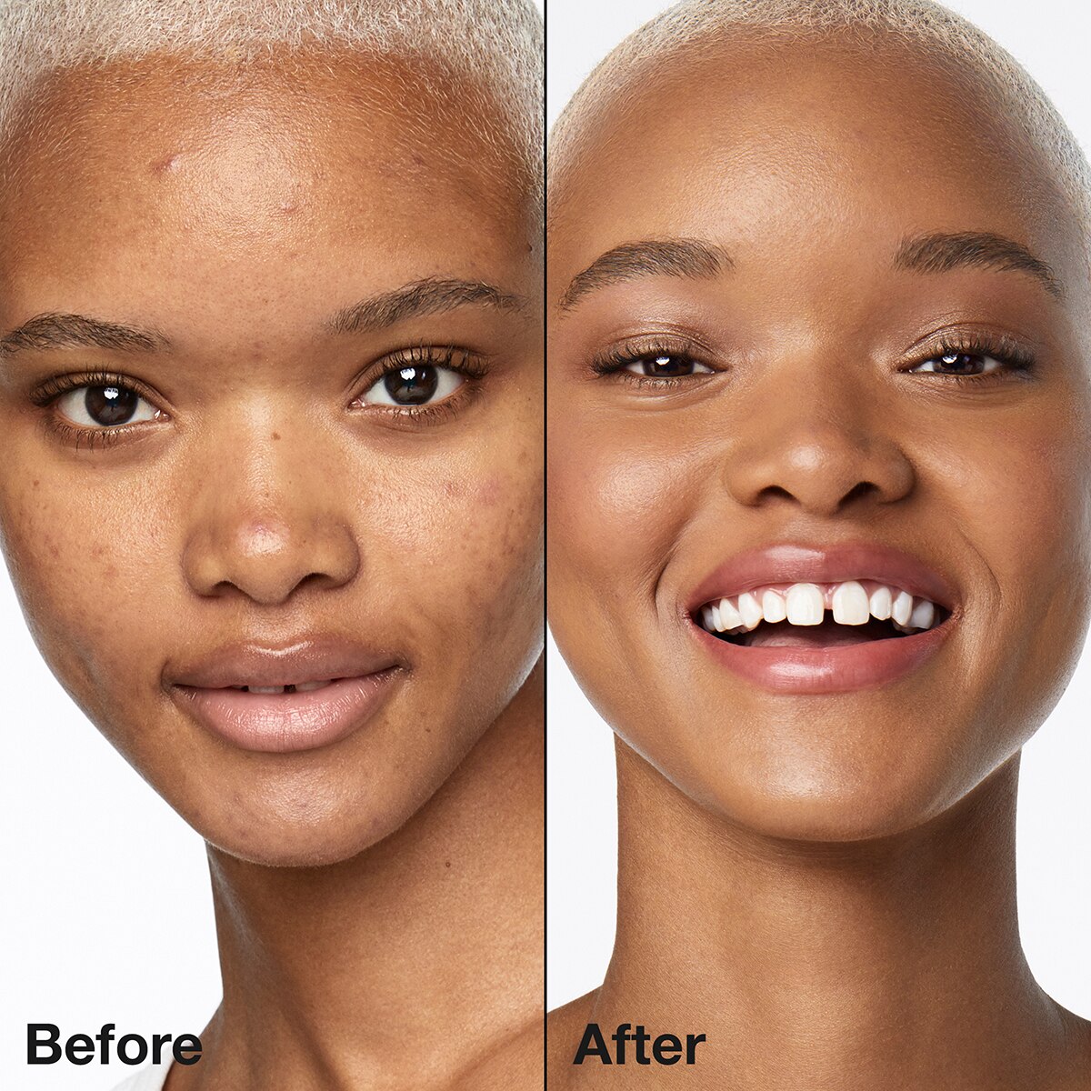 Buy ???? Clinique Even Better™ Makeup Broad Spectrum SPF 15 ???? 5 Buy ???? Clinique Even Better™ Makeup Broad Spectrum SPF 15 ???? - Image 5