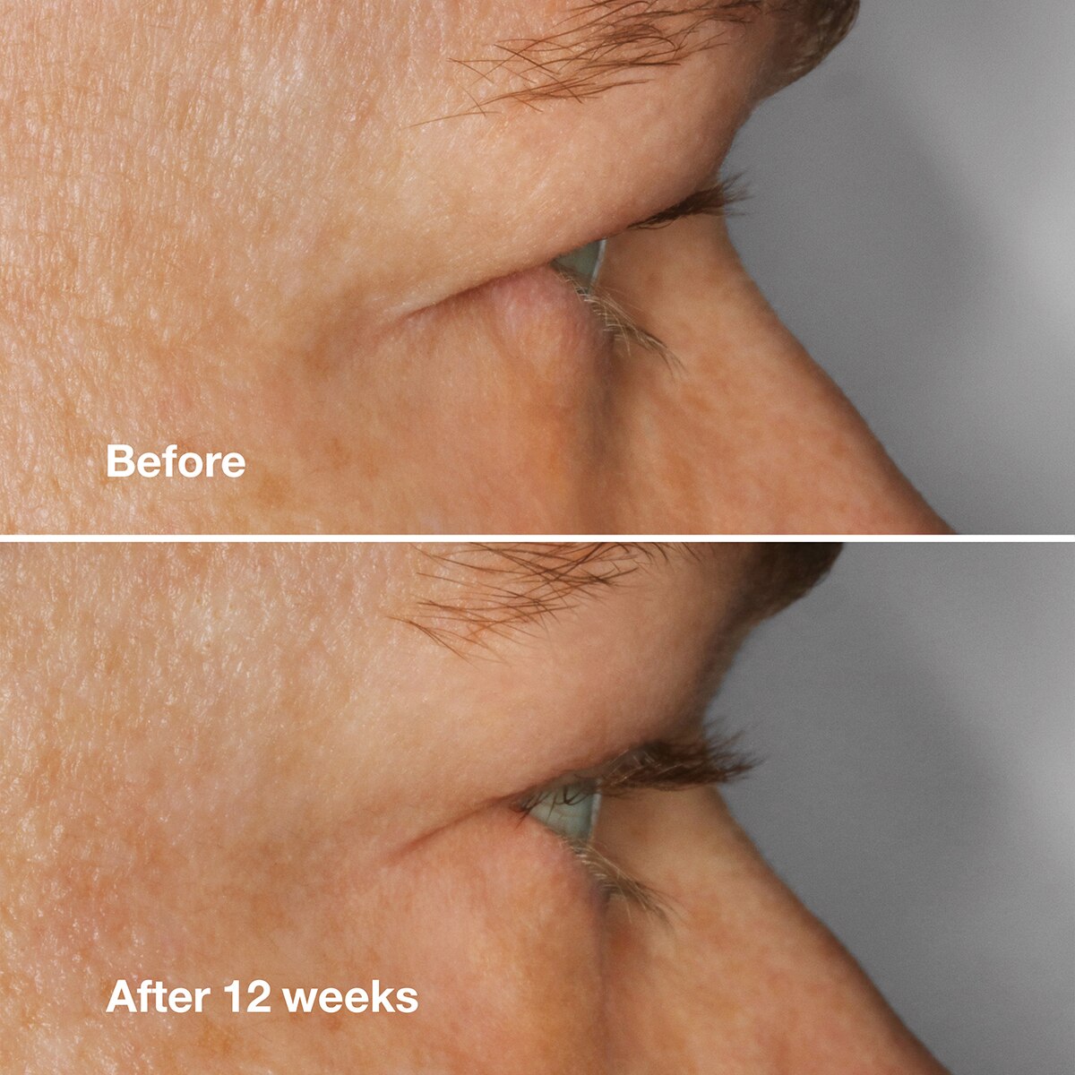 Clinique High Impact™ Lash Amplifying Serum Top 10 ???? Makeup Clinique High Impact™ Lash Amplifying Serum ???? -Elizabeth Arden - shop unnamed file 410