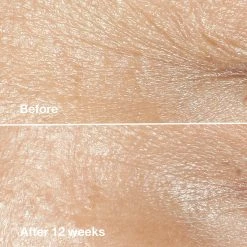 Best Pirce 🛒 Skincare Clinique Smart Clinical Repair™ Wrinkle Correcting Cream 🥰 7 Best Pirce 🛒 Skincare Clinique Smart Clinical Repair™ Wrinkle Correcting Cream 🥰 -Elizabeth Arden - shop unnamed file 562