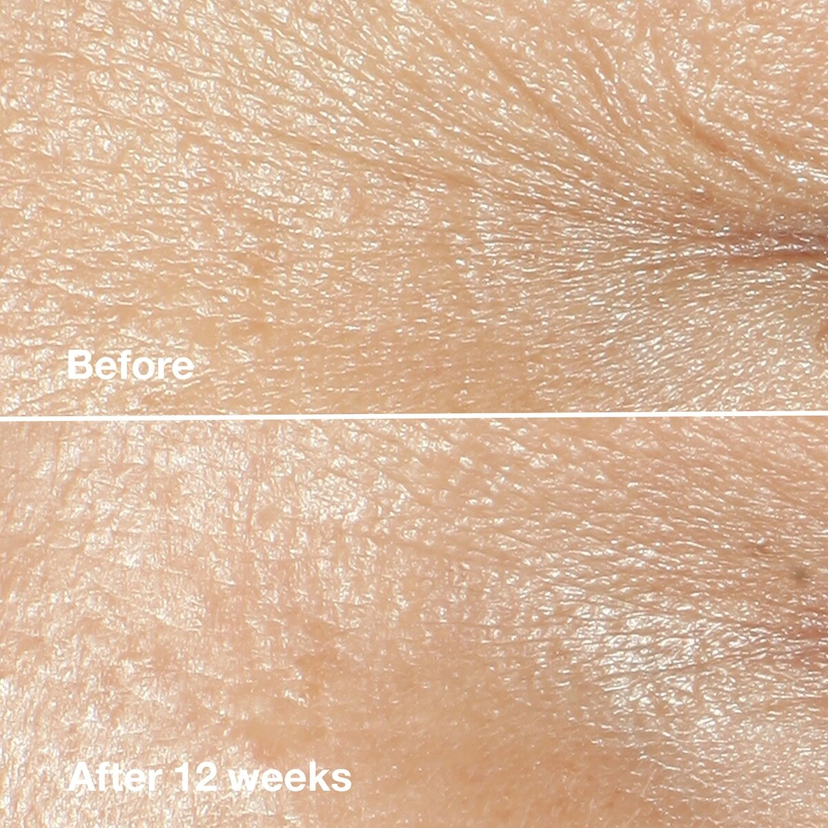 Best Pirce 🛒 Skincare Clinique Smart Clinical Repair™ Wrinkle Correcting Cream 🥰 3 Best Pirce 🛒 Skincare Clinique Smart Clinical Repair™ Wrinkle Correcting Cream 🥰 - Image 3